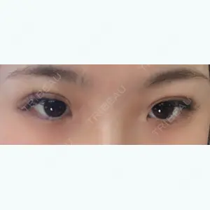 0 days after image
