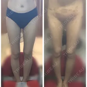 6 days after image