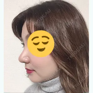 68 days after image
