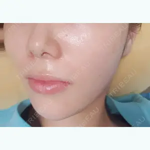 36 days after image