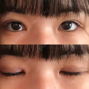 94 days after image