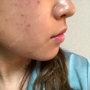 13 days after image