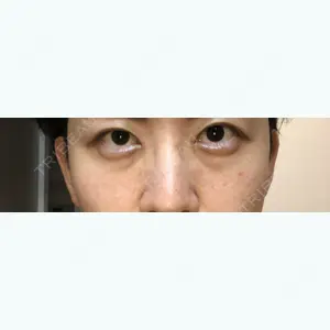 123 days after image