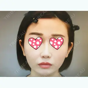 19 days after image