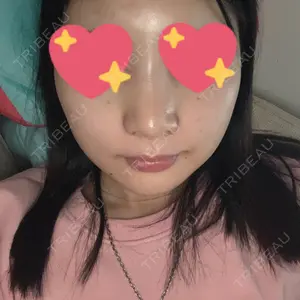 31 days after image