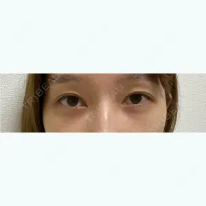 29 days after image