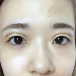31 days after image