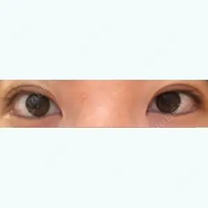 12 days after image