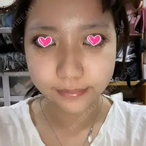 79 days after image