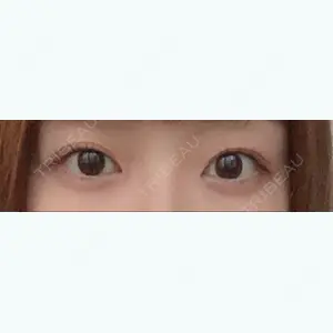 196 days after image