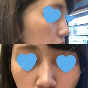 29 days after image