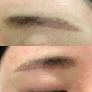 33 days after image