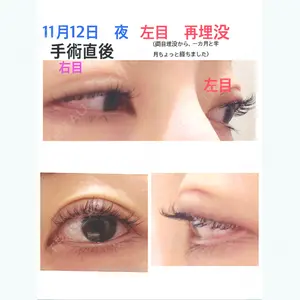 53 days after image