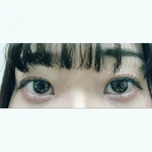 17 days after image