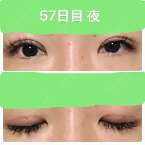 57 days after image