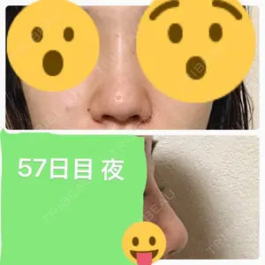 57 days after image