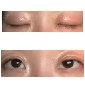 28 days after image