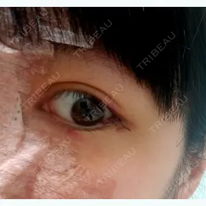 6 days after image
