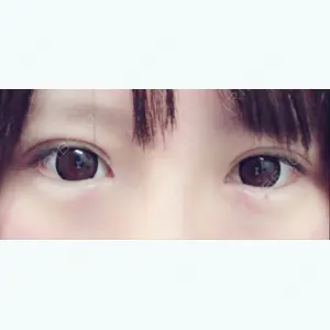 35 days after image