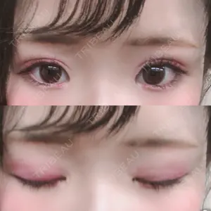 198 days after image