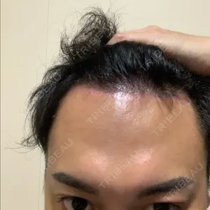 81 days after image