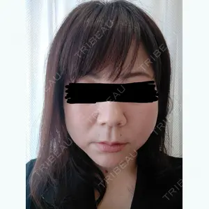 1 days after image
