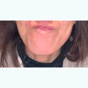 16 days after image