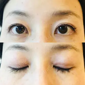 77 days after image