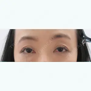 31 days after image