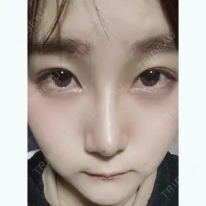 30 days after image