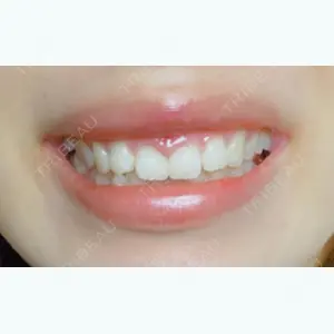 9 days after image