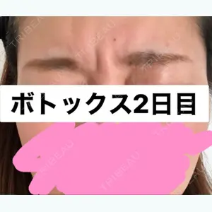 1 days after image
