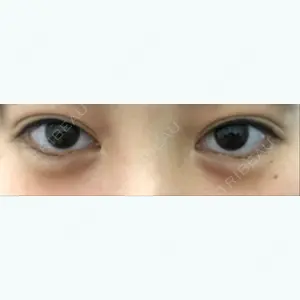 34 days after image