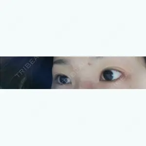 117 days after image