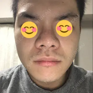 63 days after image