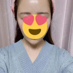34 days after image
