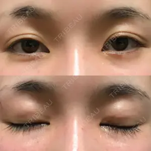 8 days after image