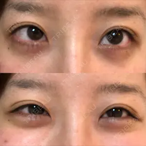 22 days after image