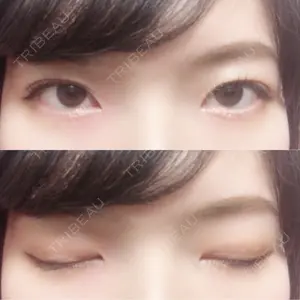 300 days after image