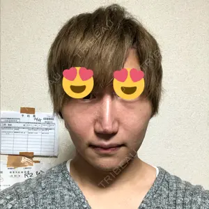 21 days after image