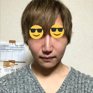 21 days after image