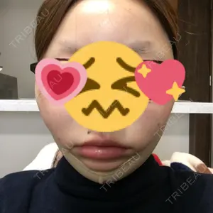 7 days after image