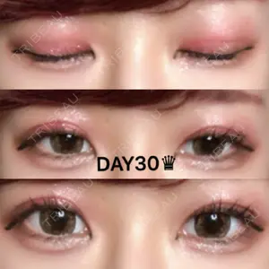 30 days after image