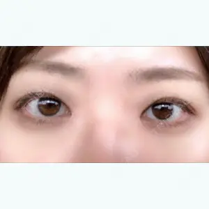 108 days after image