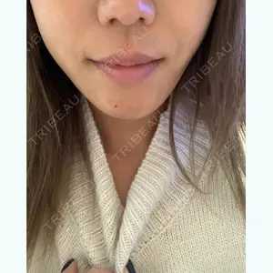16 days after image