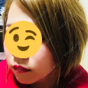 120 days after image