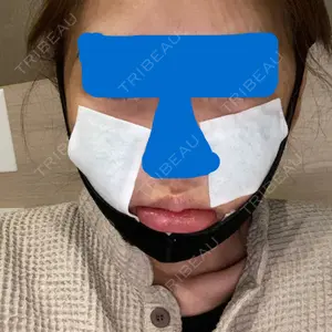3 days after image