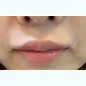 86 days after image