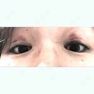 0 days after image