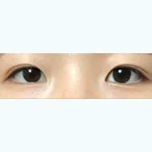 56 days after image